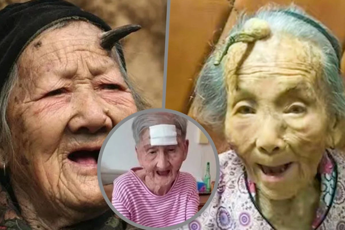 Chinese grandma cuts ‘longevity horn off forehead with scissors needs emergency surgery granmdawise.com 1 1