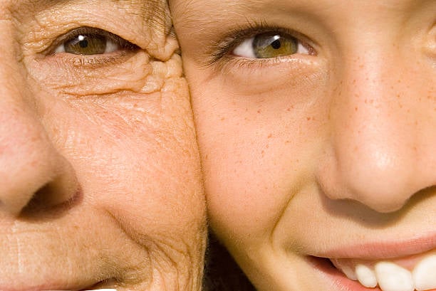Freckles